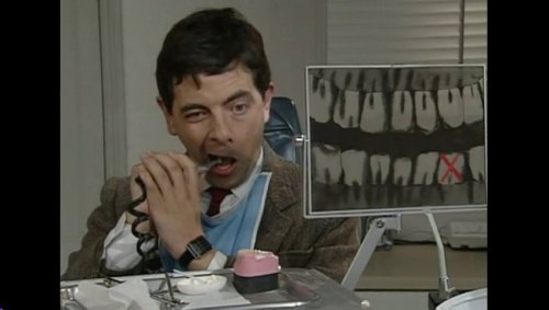 eGZmNjd1MTI=_o_mr-bean---fixing-his-own-teeth